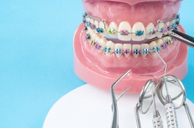 braces model and dental instruments