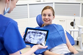 Digital dental x-rays