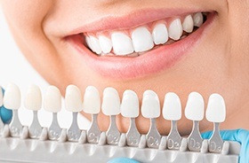 Closeup of smile compared with tooth color chart