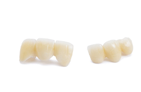 Two porcelain dental bridges resting on white background