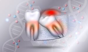 Illustration of wisdom tooth in front of DNA molecules